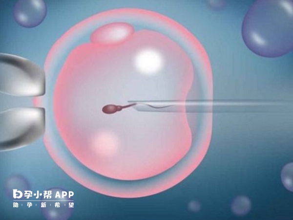 南通试管婴儿