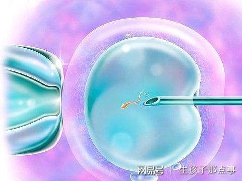 人流手术