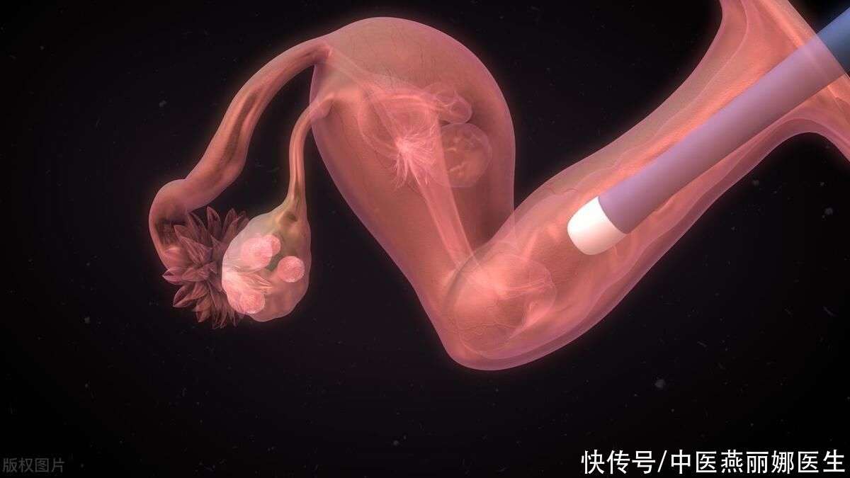 人流手术