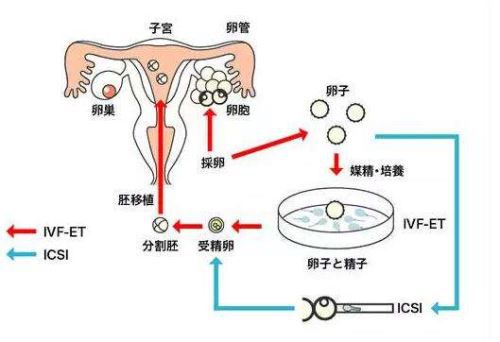 人流手术