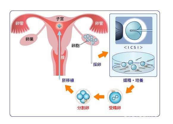 人流手术
