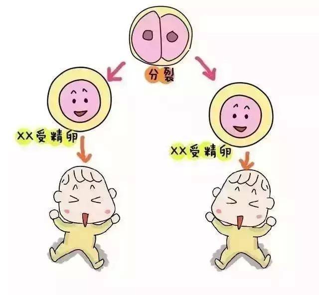 人流手术