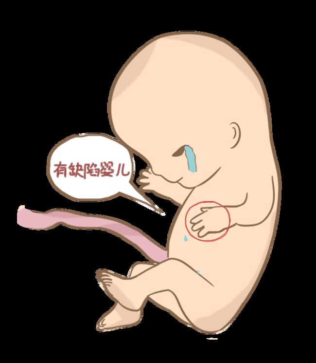 人流手术