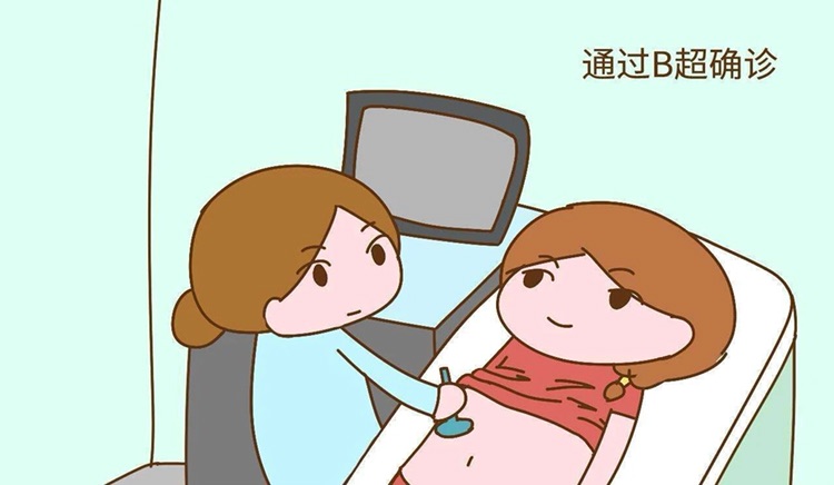 人流手术
